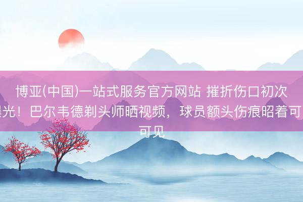 博亚(中国)一站式服务官方网站 摧折伤口初次曝光！巴尔韦德剃头师晒视频，球员额头伤痕昭着可见